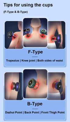 Conjunto de Cupping Hijama personalizado Massagista de Cupping Therapy para Fitdash F-Type Cupping-Cups