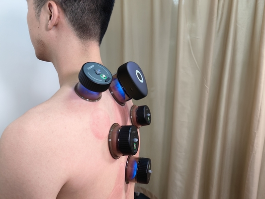 Experimente o futuro da terapia de ventosas com o Fitdash Smart Massager Button Control