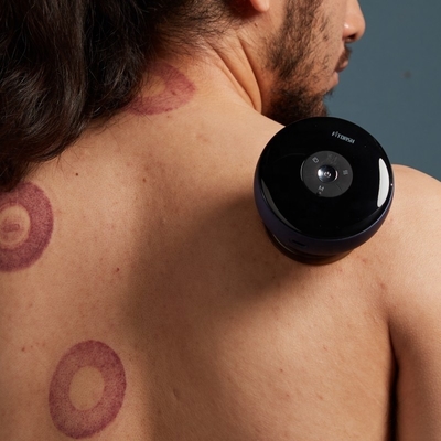 ABS PC Fitdash Massageador Elétrico de Cupping com Sucção a Vácuo e Vibração Eletrônica
