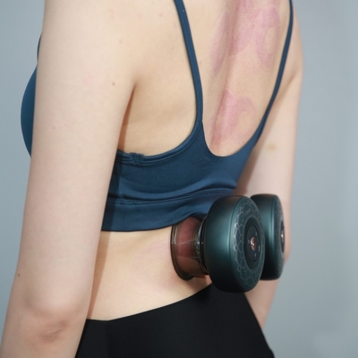 ABS PC Profissional Cupping Set Massagista de vácuo de raspagem elétrica para terapia de ventosas