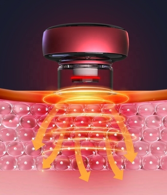 94*94*72mm Tamanho Massagista Elétrico de Cupping para aquecimento de todo o corpo e conjunto de Cupping Fascial