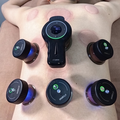 Experimente os Benefícios da Terapia Elétrica de Cupping com o Nosso Dispositivo de Cupping