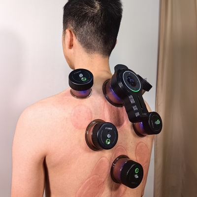 Experimente os Benefícios da Terapia Elétrica de Cupping com o Nosso Dispositivo de Cupping