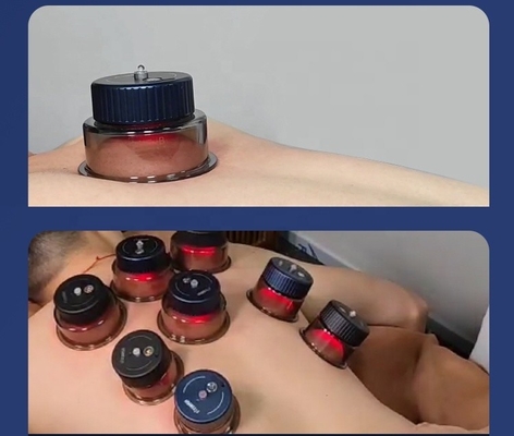 Cúpula de respiração inteligente com -10 kPa -60 kPa Força de sucção e Cúpula de 3,7V/150mAh