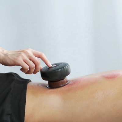 Fitdash Massagem elétrica de ventosas com terapia de luz vermelha para alívio da dor EMC Certificado