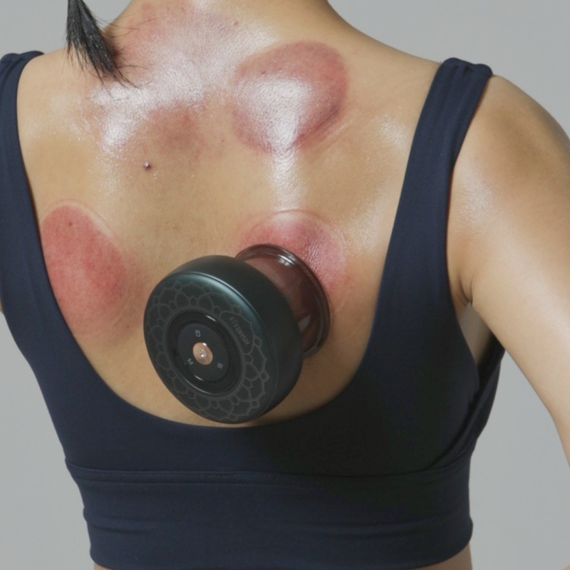 Fonte de energia Carregar Ferramenta profissional de massagem Gua Sha para redução de celulite ABS P