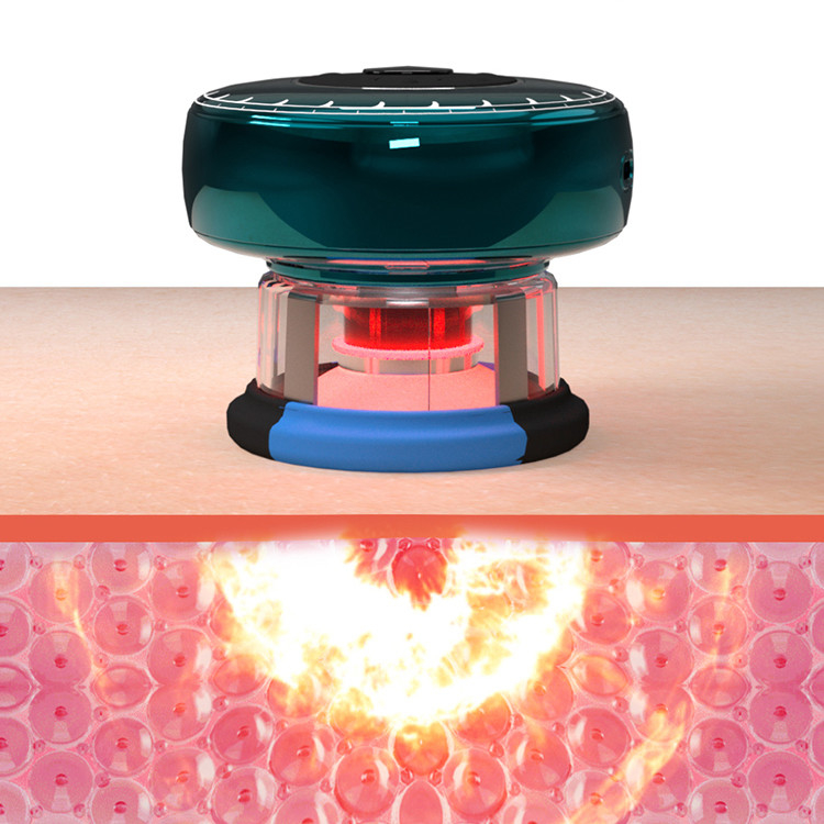 Fitdash TENS Smart Vacuum Copper Carregável e fácil para melhorar a circulação sanguínea
