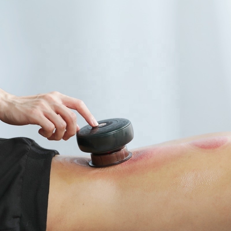 Fitdash Massagem elétrica de ventosas com terapia de luz vermelha para alívio da dor EMC Certificado